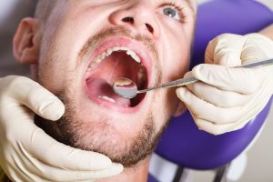 Canker Sore or Oral Cancer?