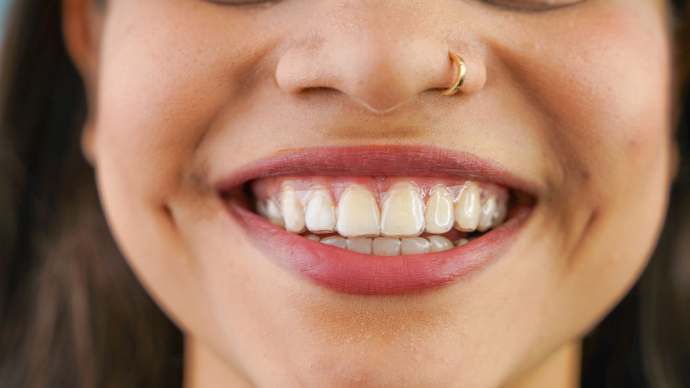 Signs You May Be Overworking Your Jaw