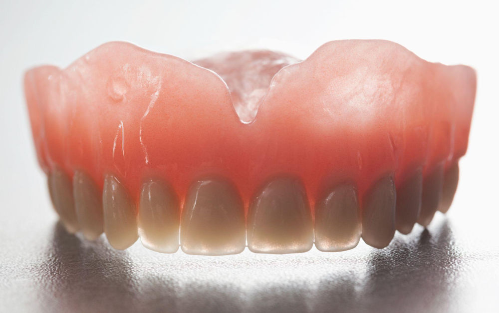 Who Is a Good Candidate for Implant Dentures?